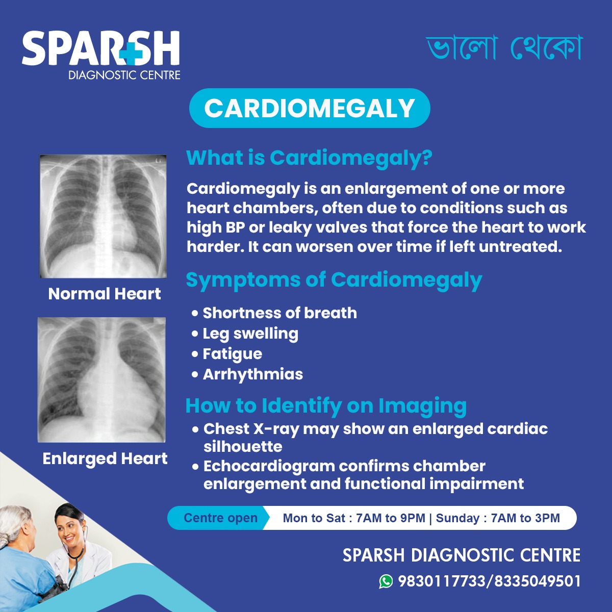 What Is Cardiomegaly