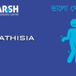 Akathisia