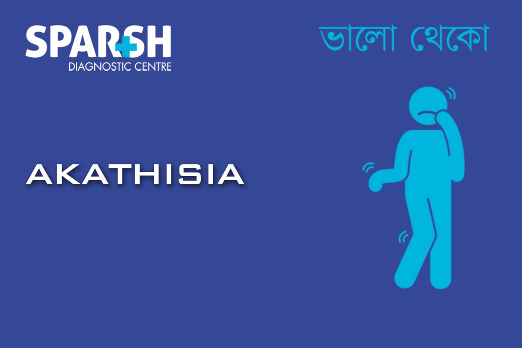 Akathisia