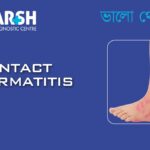 Contact Dermatitis