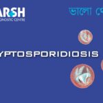 Cryptosporidiosis