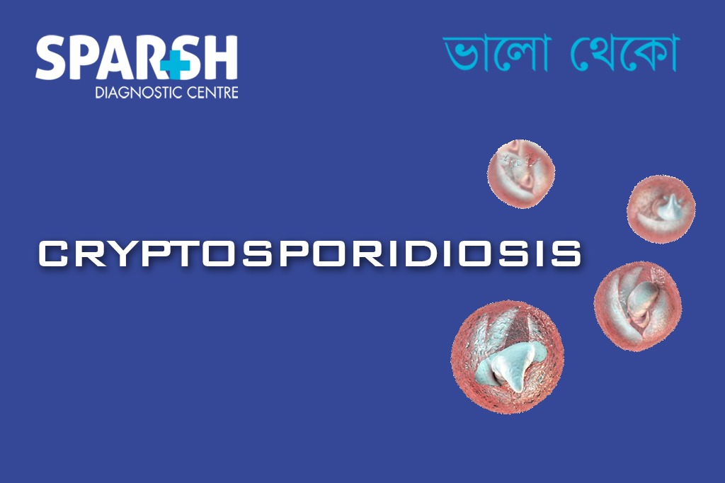 Cryptosporidiosis