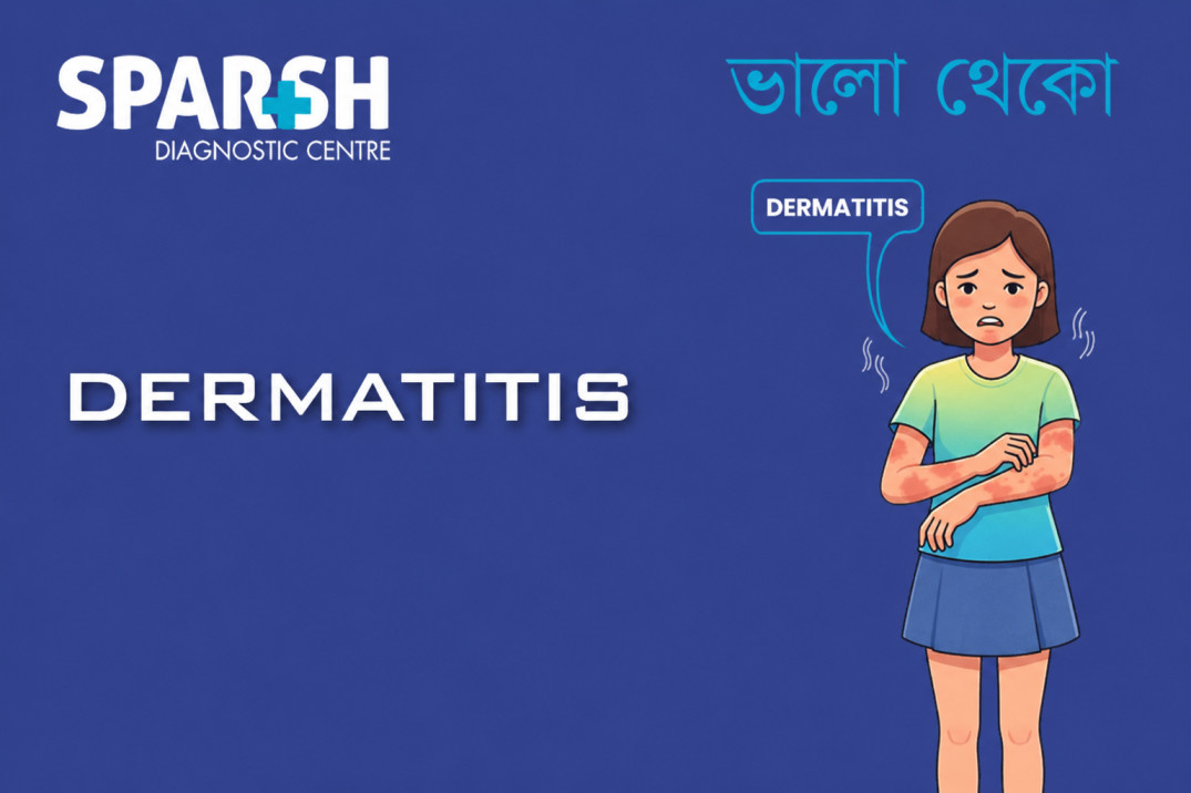 Dermatitis