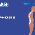 Kyphosis