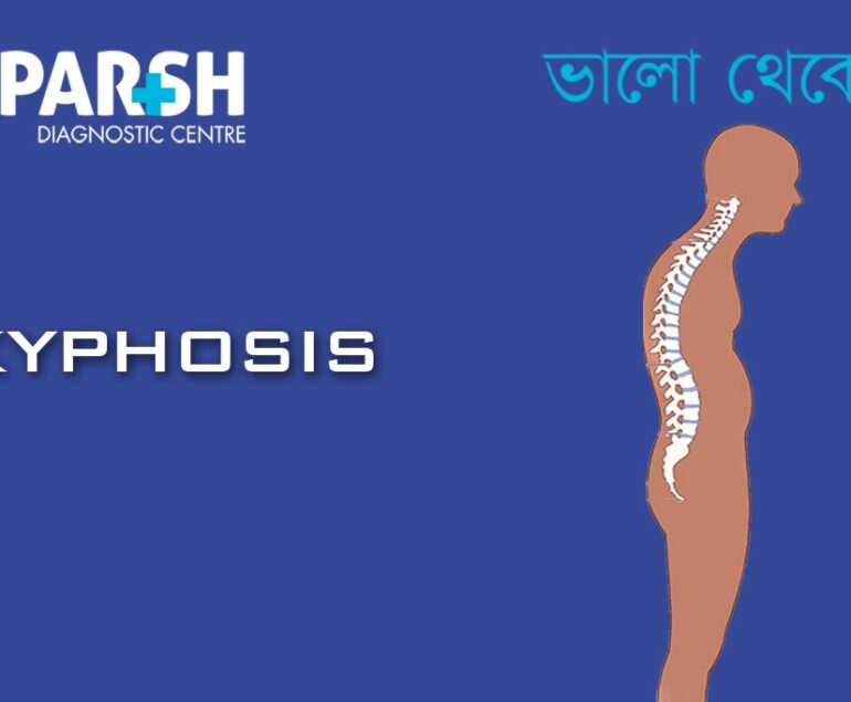 Kyphosis