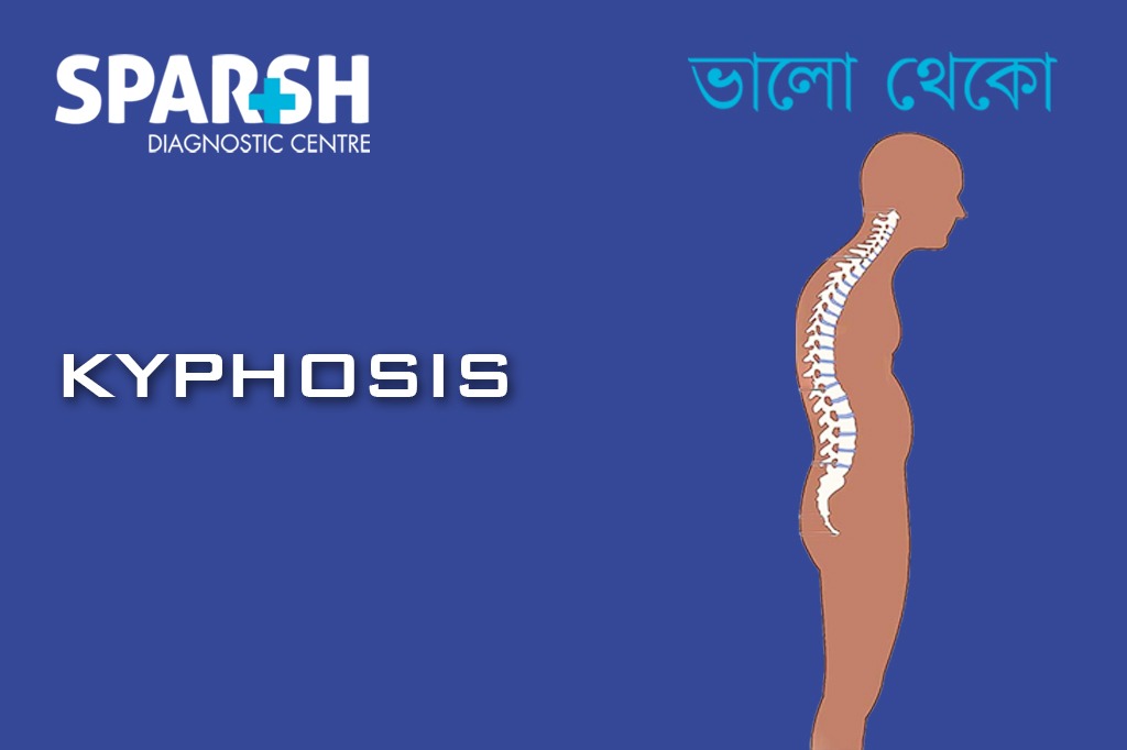 Kyphosis