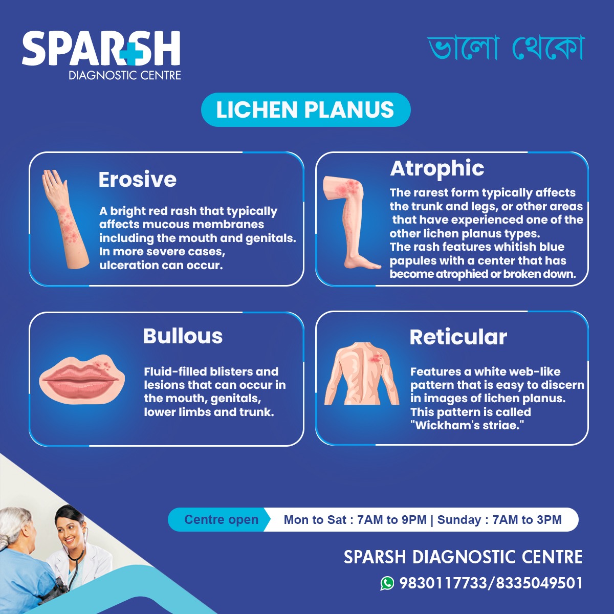 Lichen Planus