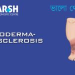 Lipodermatosclerosis