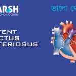 Patent Ductus Arteriosus PDA