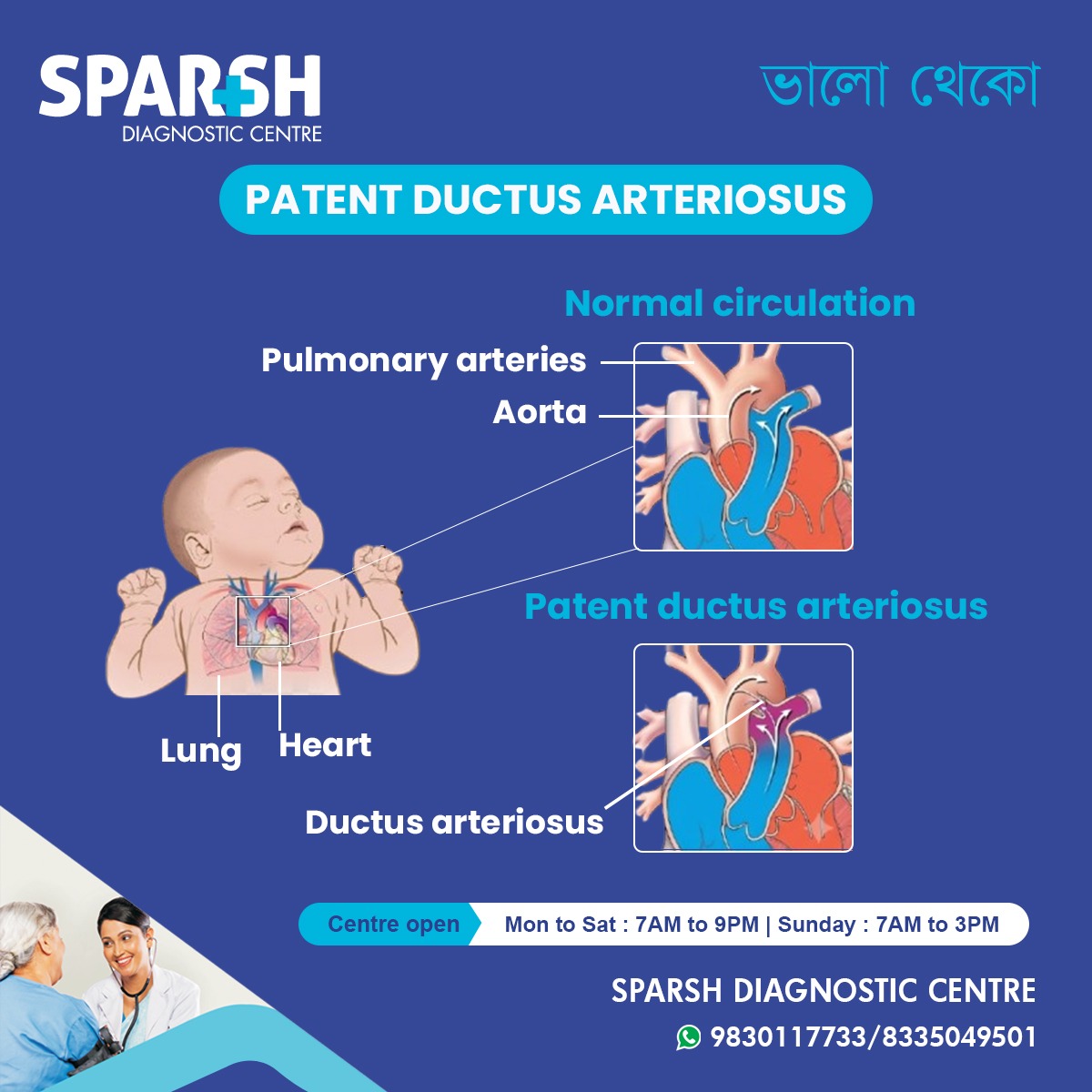 Patent Ductus Arteriosus