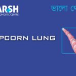 Popcorn Lung