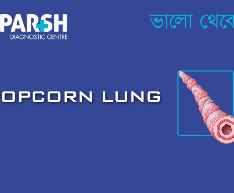 Popcorn Lung
