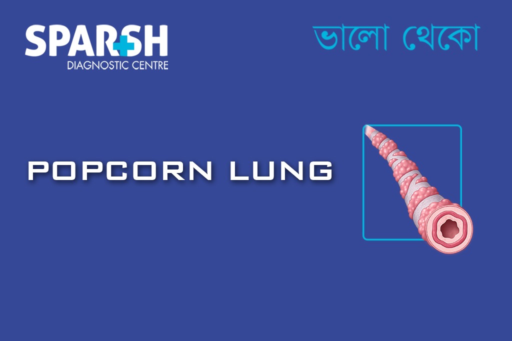 Popcorn Lung