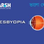 Presbyopia