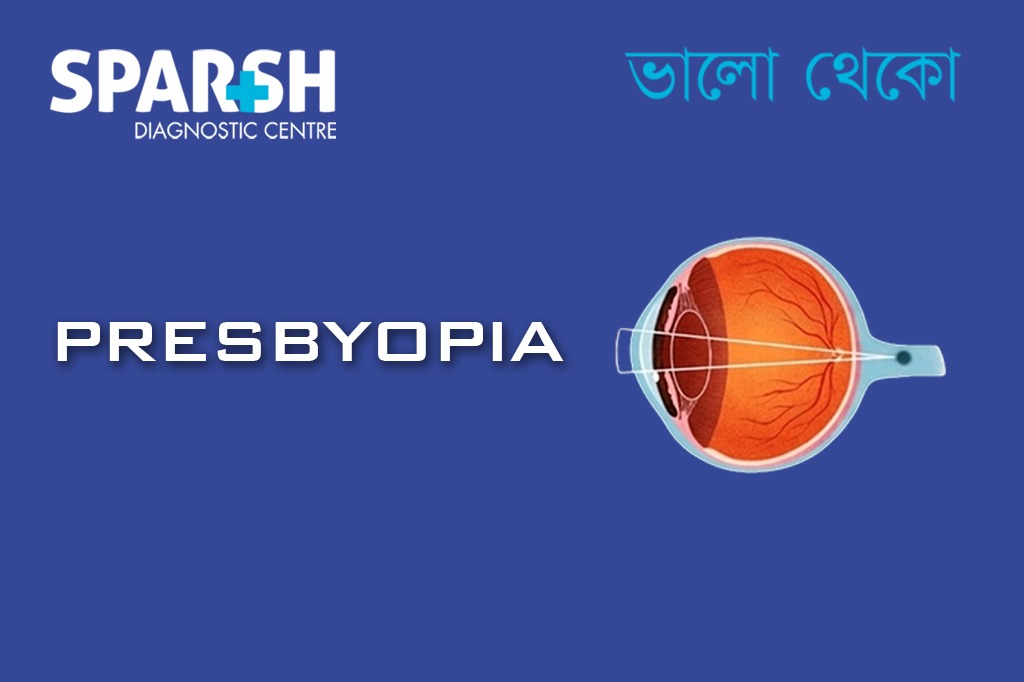 Presbyopia
