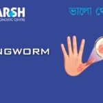 Ringworm