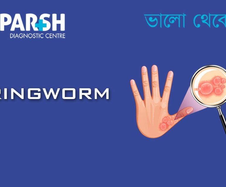 Ringworm