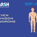 Steven Johnson Syndrome