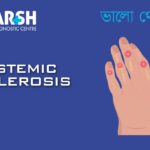 Systemic Sclerosis