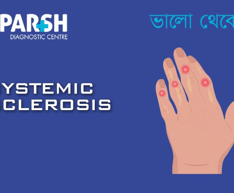 Systemic Sclerosis