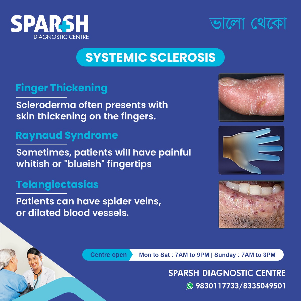 Systemic Sclerosis Symptoms