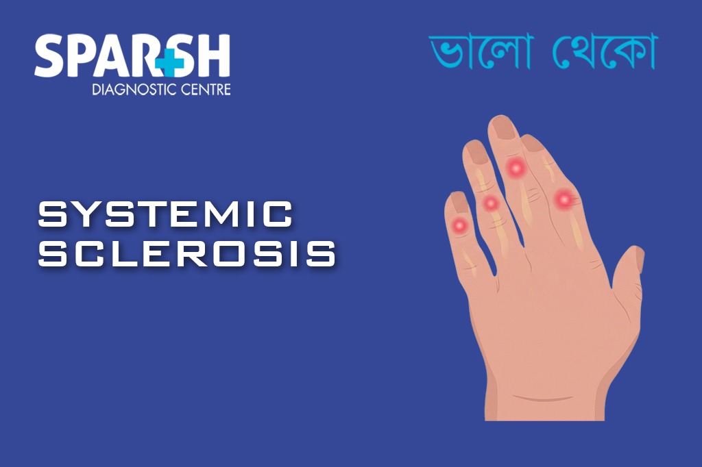 Systemic Sclerosis