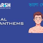 Viral Exanthems