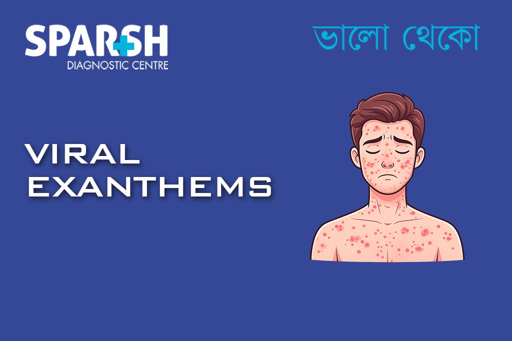 Viral Exanthems