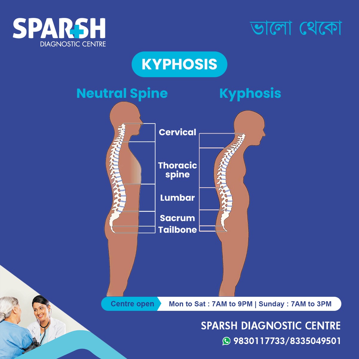 What Is Kyphosis