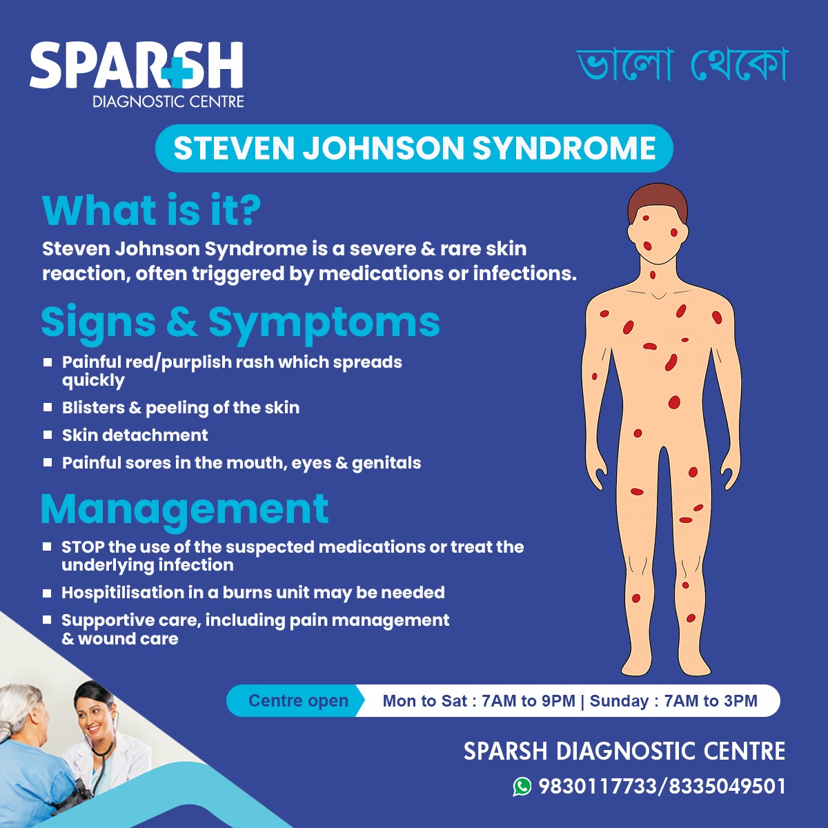 What Is Steven Johnson Syndrome