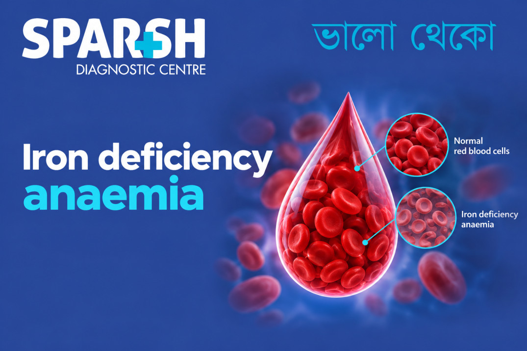 Iron Deficiency Anaemia