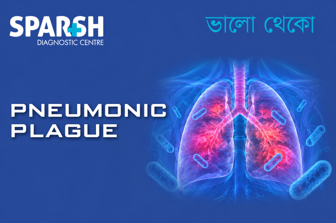 Pneumonic Plague